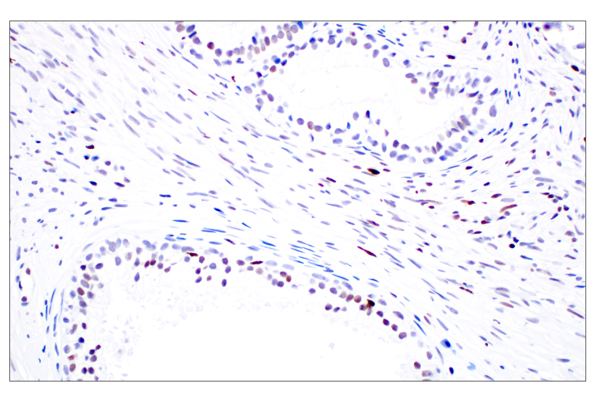 Immunohistochemistry Image 3: Phospho-Histone H3 (Ser10) (D7N8E) Rabbit Monoclonal Antibody