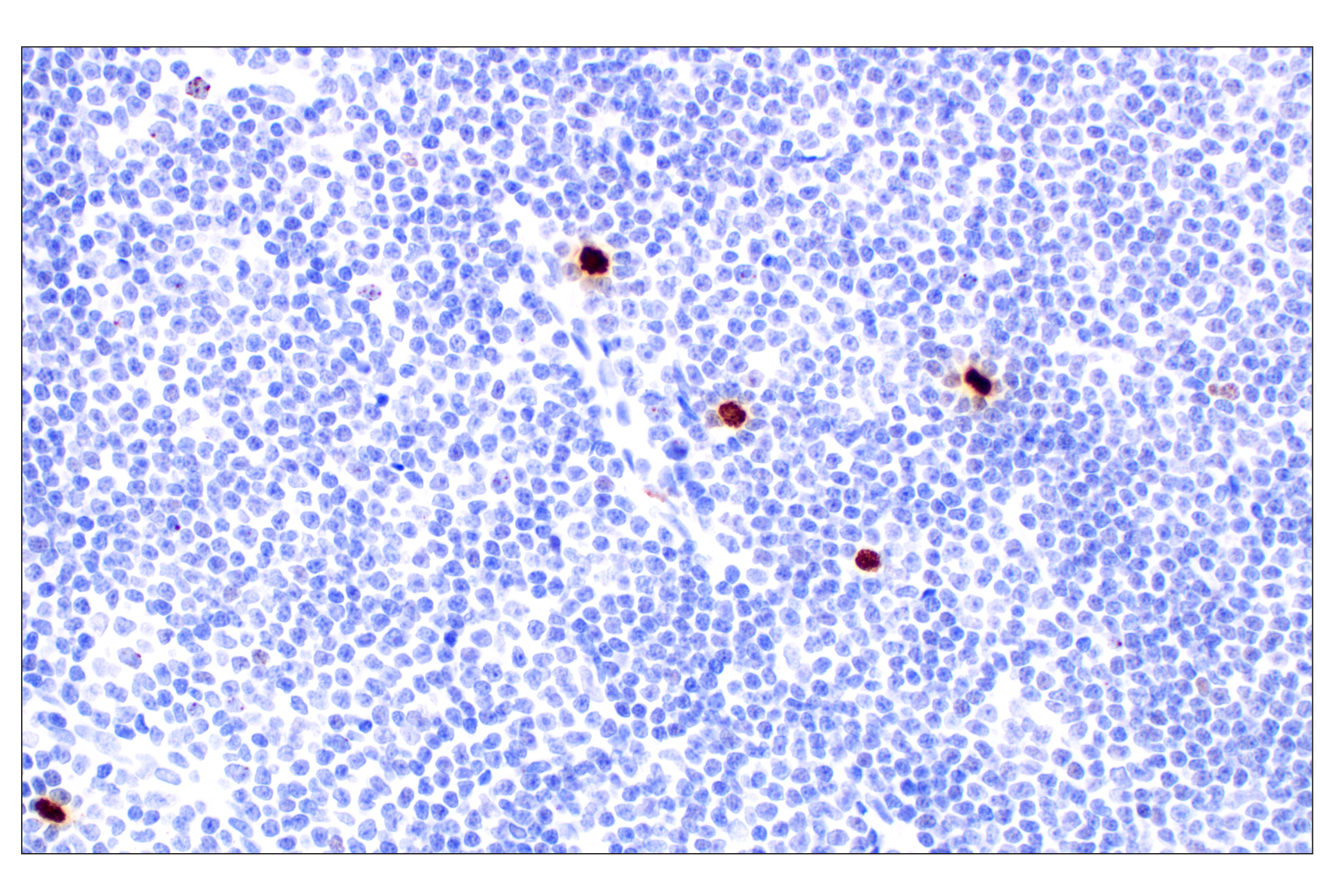 Immunohistochemistry Image 2: Phospho-Histone H3 (Ser10) (D7N8E) Rabbit Monoclonal Antibody