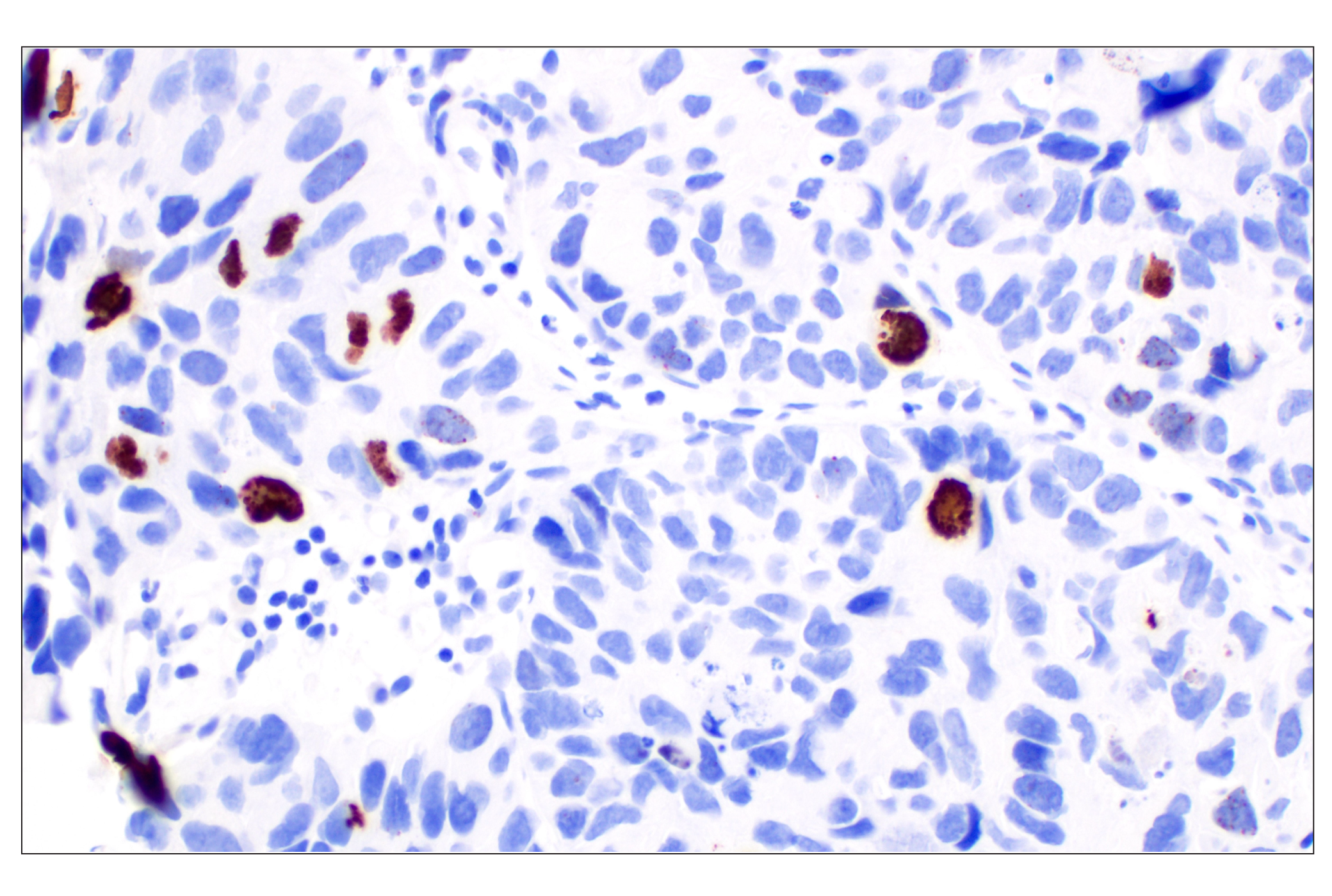 Immunohistochemistry Image 1: Phospho-Histone H3 (Ser10) (D7N8E) Rabbit Monoclonal Antibody