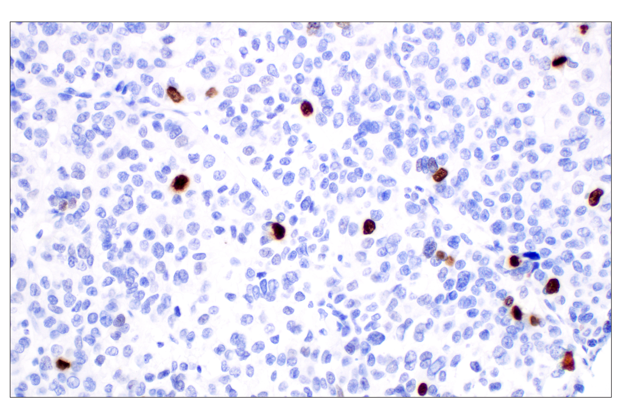 Immunohistochemistry Image 1: Phospho-Histone H3 (Ser10) (D7N8E) Rabbit Monoclonal Antibody