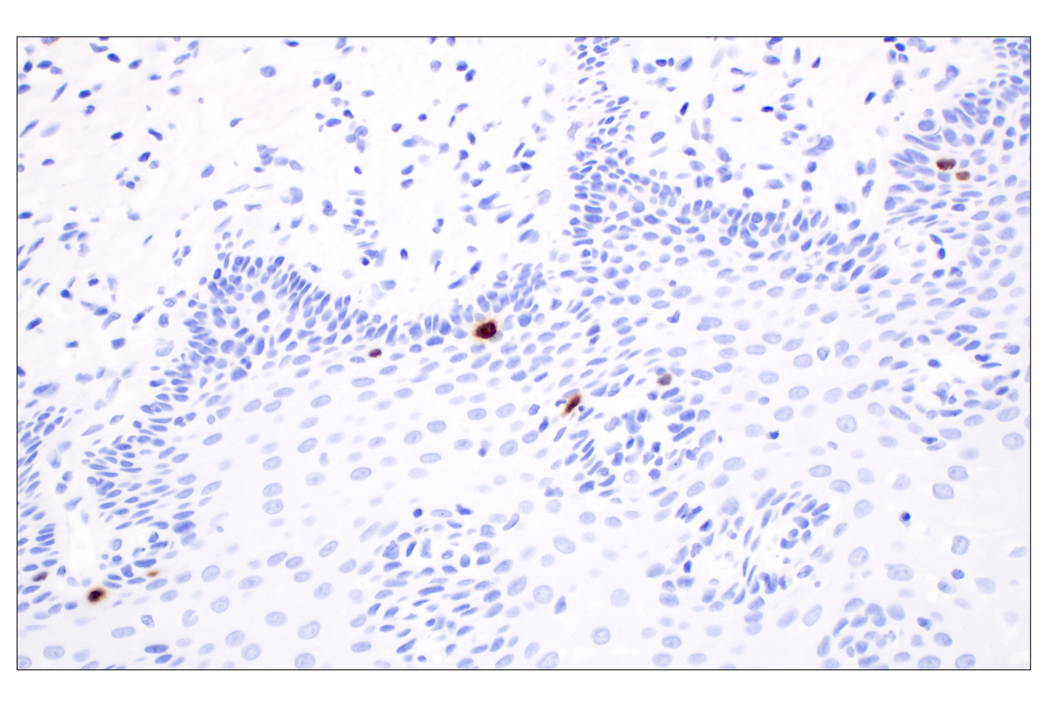 Immunohistochemistry Image 6: Phospho-Histone H3 (Ser10) (D7N8E) Rabbit Monoclonal Antibody