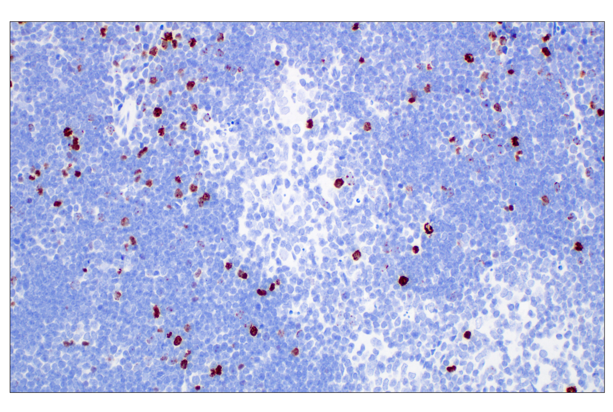 Immunohistochemistry Image 11: Phospho-Histone H3 (Ser10) (D7N8E) Rabbit Monoclonal Antibody