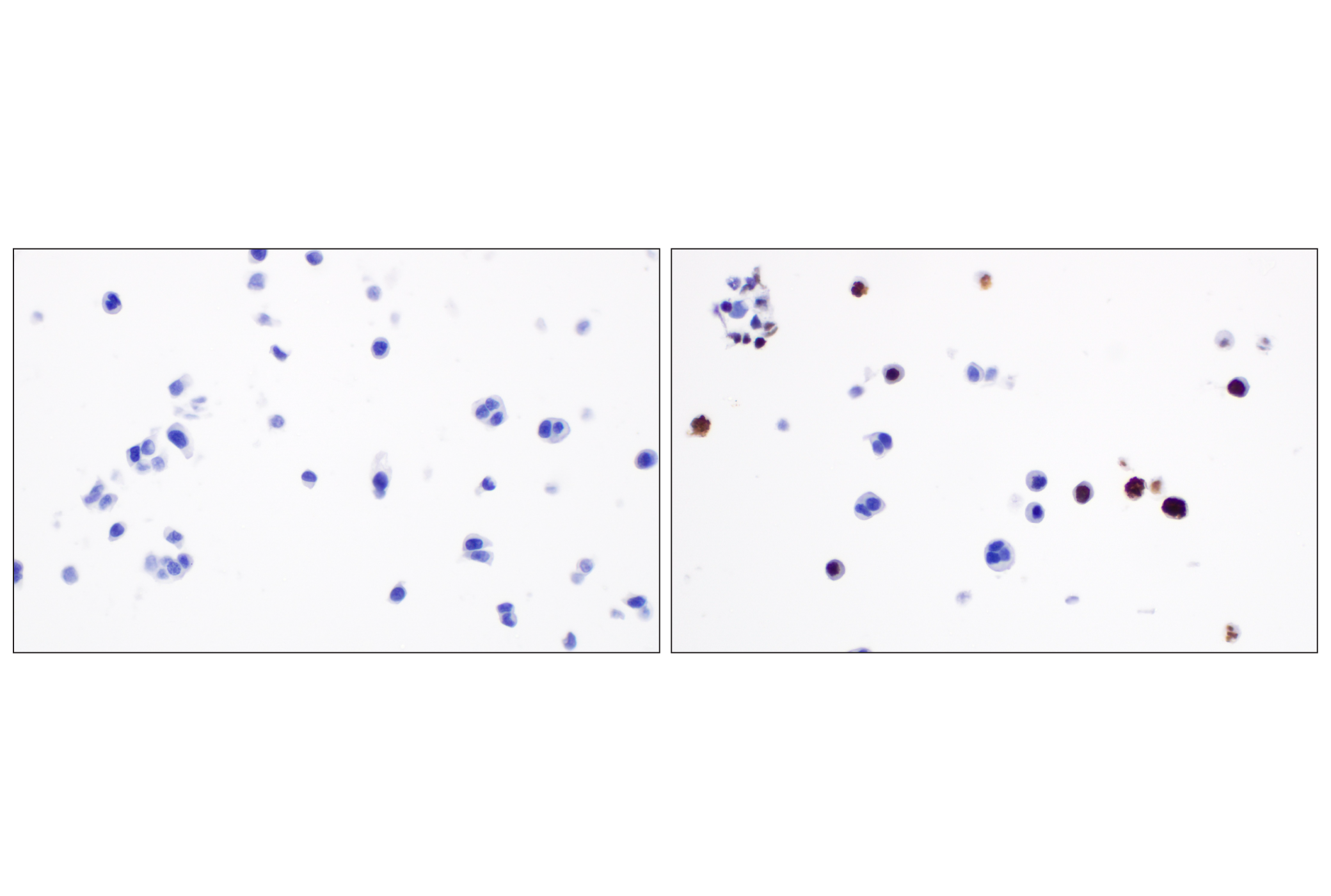 Immunohistochemistry Image 10: Phospho-Histone H3 (Ser10) (D7N8E) Rabbit Monoclonal Antibody