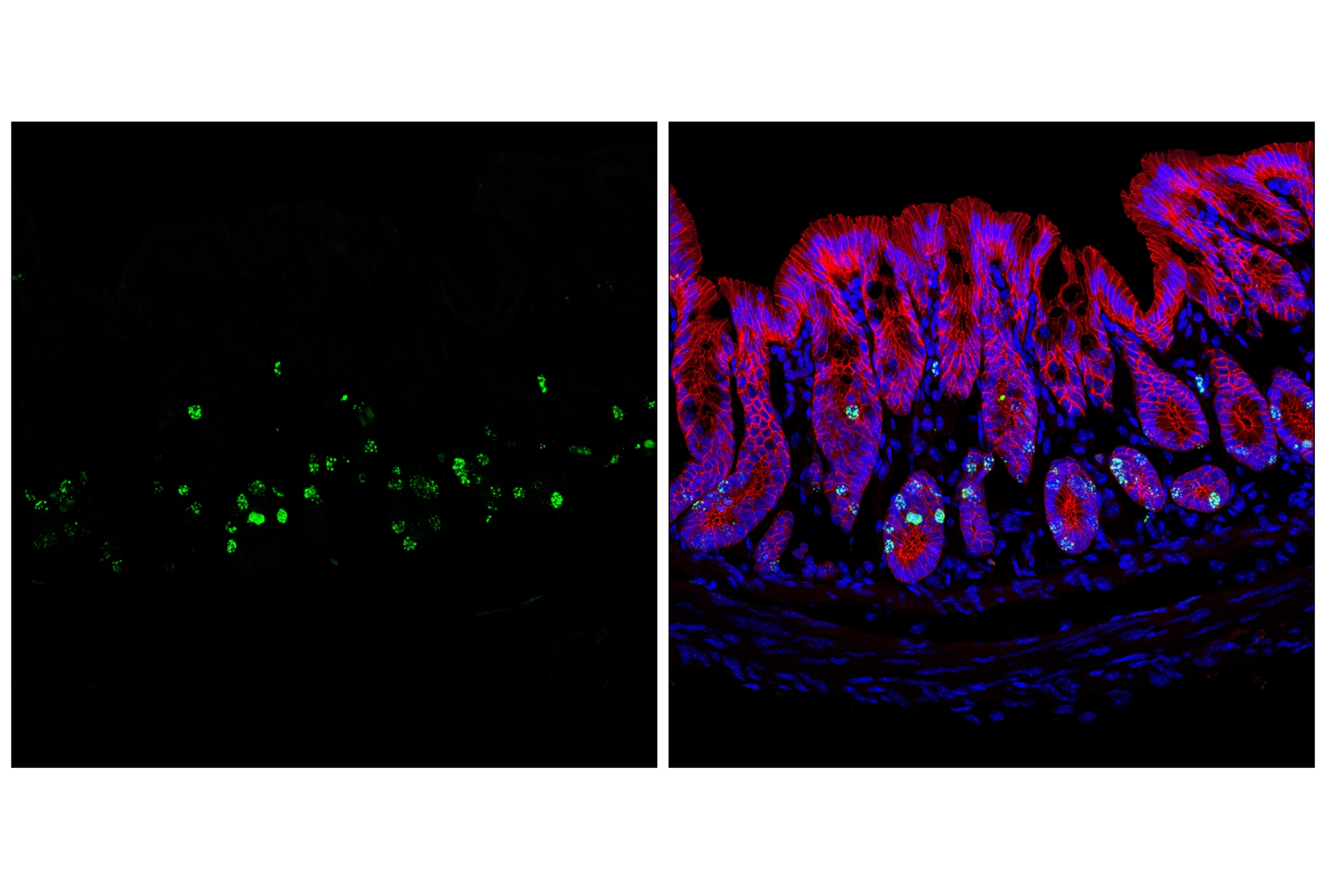 Immunofluorescence Image 1: Phospho-Histone H3 (Ser10) (D7N8E) Rabbit Monoclonal Antibody