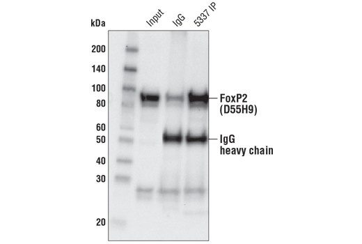Immunoprecipitation Image 1: FoxP2 (D55H9) Rabbit mAb