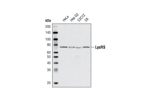 Western Blotting Image 1: LysRS Antibody
