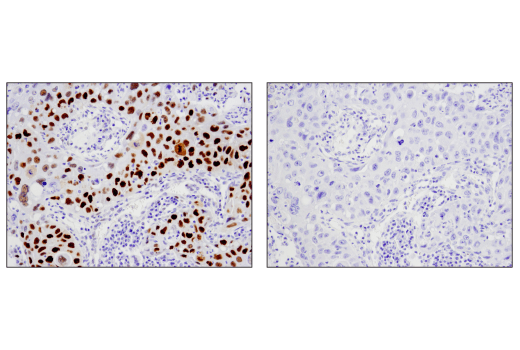 Immunohistochemistry Image 1: Mouse (E7Q5L) mAb IgG2b Isotype Control