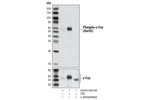  Image 4: Fos Family Antibody Sampler Kit