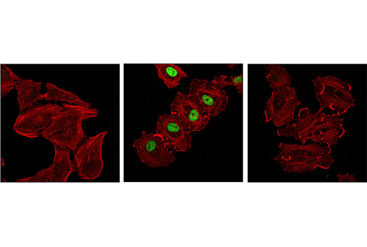 Immunofluorescence Image 2: Phospho-c-Fos (Ser32) (D82C12) XP® Rabbit mAb