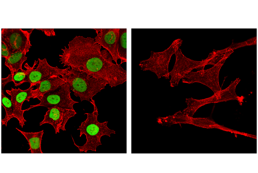 Immunofluorescence Image 1: FoxA1/HNF3α (E7E8W) Rabbit mAb