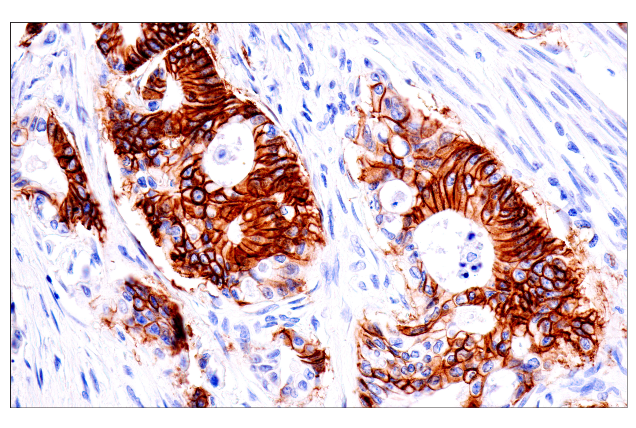 Immunohistochemistry Image 3: Cadherin-17 (E5J8Z) Rabbit mAb (BSA and Azide Free)