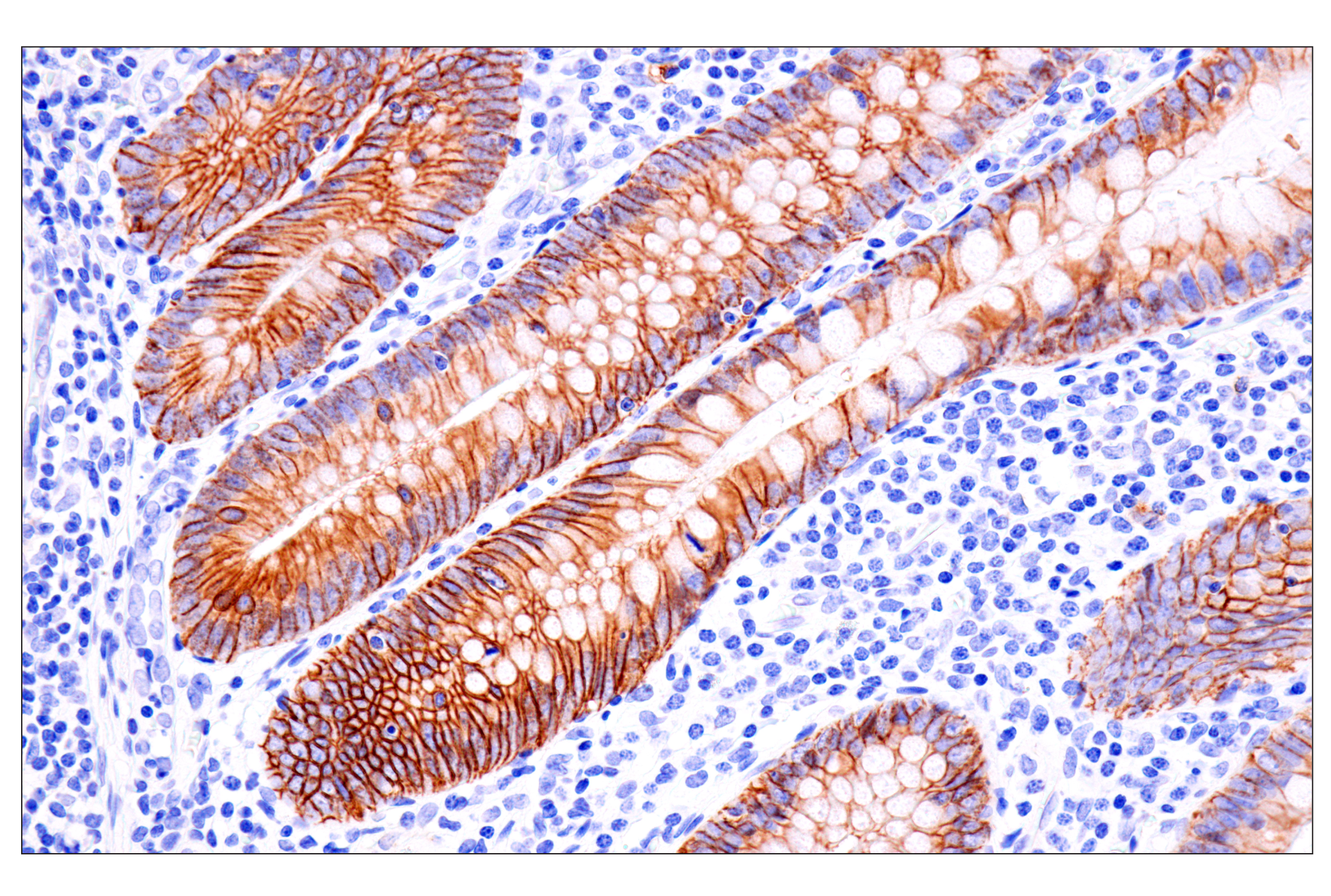 Immunohistochemistry Image 5: Cadherin-17 (E5J8Z) Rabbit mAb (BSA and Azide Free)
