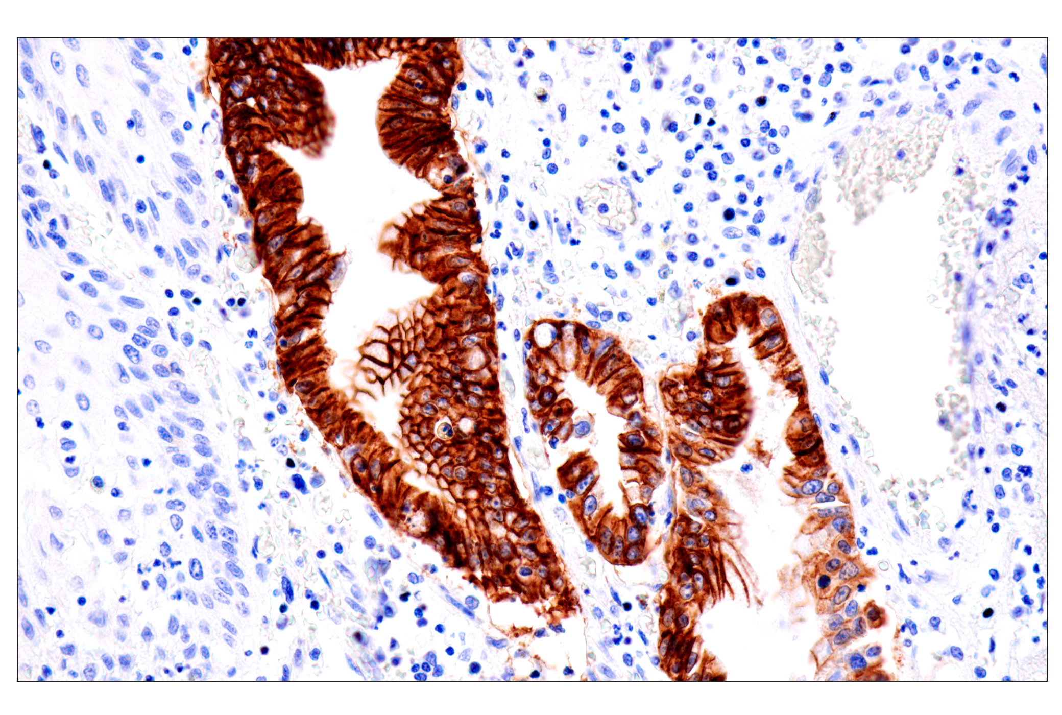 Immunohistochemistry Image 2: Cadherin-17 (E5J8Z) Rabbit mAb (BSA and Azide Free)
