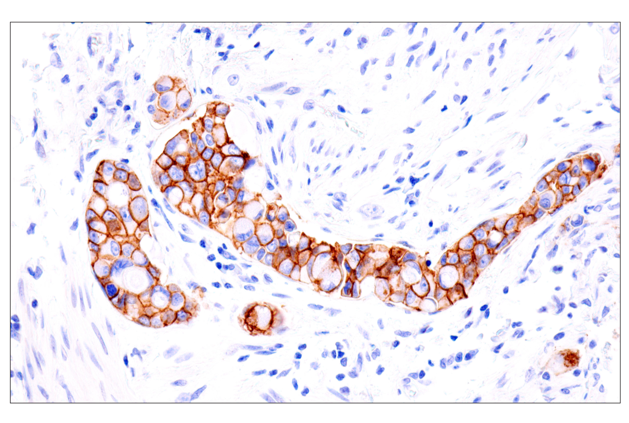 Immunohistochemistry Image 1: Cadherin-17 (E5J8Z) Rabbit mAb (BSA and Azide Free)