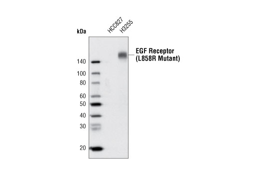 Western Blotting Image 1: EGF Receptor (L858R Mutant Specific) (43B2) Rabbit mAb (Biotinylated)