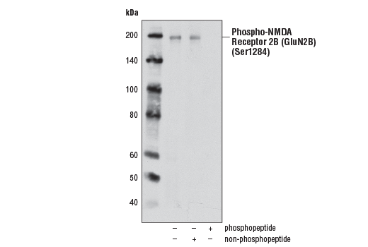 Western Blotting Image 1: Phospho-NMDA Receptor 2B (GluN2B) (Ser1284) Antibody