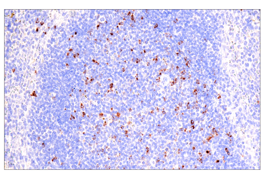 Immunohistochemistry Image 10: CTLA-4 (E2V1Z) Rabbit mAb