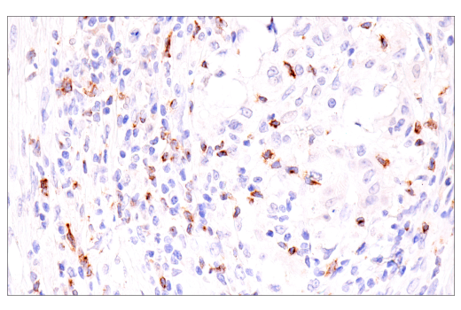 Immunohistochemistry Image 4: CTLA-4 (E2V1Z) Rabbit mAb