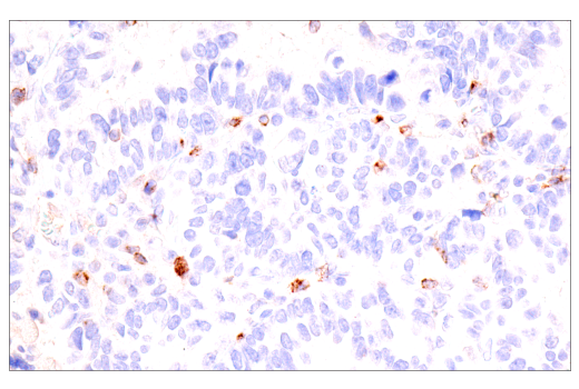 Immunohistochemistry Image 6: CTLA-4 (E2V1Z) Rabbit mAb