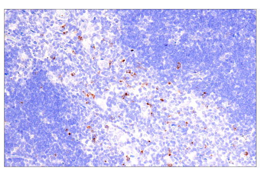 Immunohistochemistry Image 12: CTLA-4 (E2V1Z) Rabbit mAb