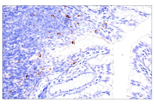 Immunohistochemistry Image 11: CTLA-4 (E2V1Z) Rabbit mAb