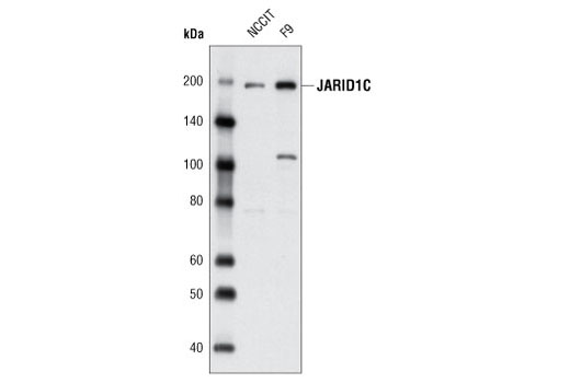  Image 4: JARID1/KDM5 Histone Demethylase Antibody Sampler Kit