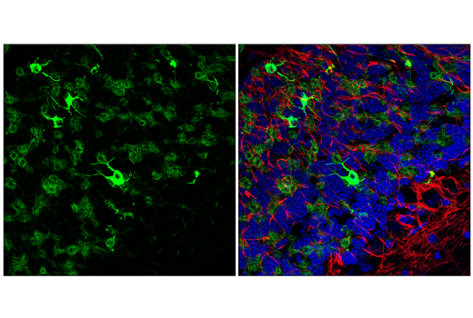 Immunofluorescence Image 1: MAP7 (E8K7O) Rabbit mAb