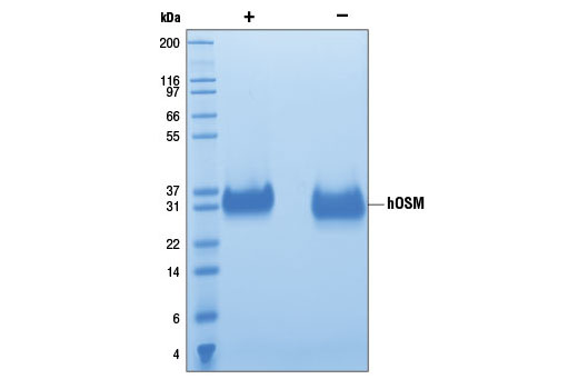 Image 2: Human Oncostatin M (hOSM)