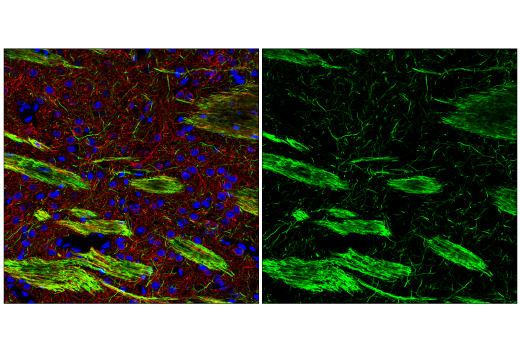 Immunofluorescence Image 1: Neurofilament-M (E7L2T) Rabbit mAb (BSA and Azide Free)
