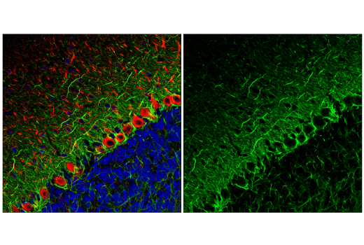 Immunofluorescence Image 2: Neurofilament-M (E7L2T) Rabbit mAb (BSA and Azide Free)