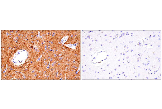 Immunohistochemistry Image 4: Neurofilament-M (E7L2T) Rabbit mAb (BSA and Azide Free)