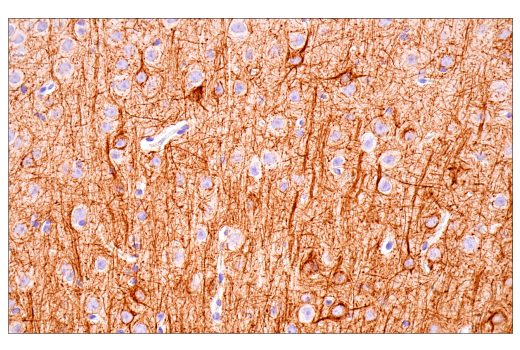 Immunohistochemistry Image 5: Neurofilament-M (E7L2T) Rabbit mAb (BSA and Azide Free)