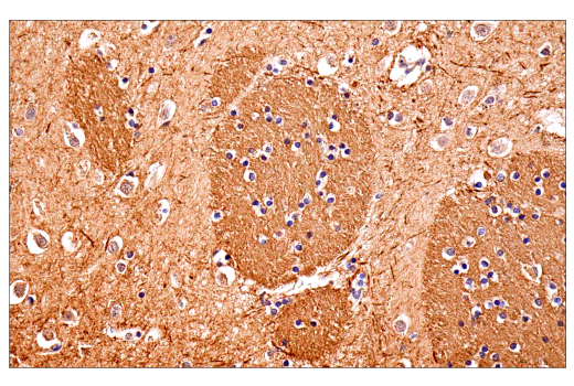 Immunohistochemistry Image 1: Neurofilament-M (E7L2T) Rabbit mAb (BSA and Azide Free)