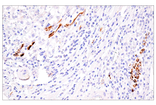 Immunohistochemistry Image 2: Neurofilament-M (E7L2T) Rabbit mAb (BSA and Azide Free)