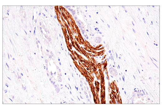 Immunohistochemistry Image 3: Neurofilament-M (E7L2T) Rabbit mAb (BSA and Azide Free)