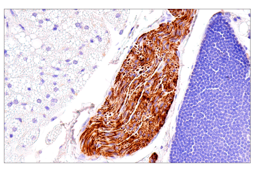 Immunohistochemistry Image 7: Neurofilament-M (E7L2T) Rabbit mAb (BSA and Azide Free)