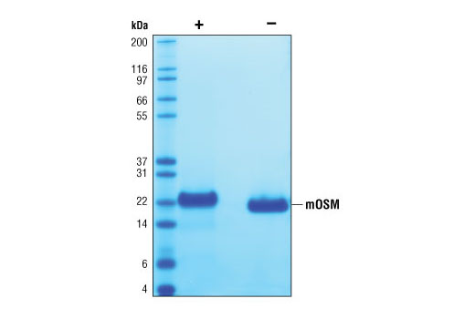  Image 2: Mouse Oncostatin M (mOSM)