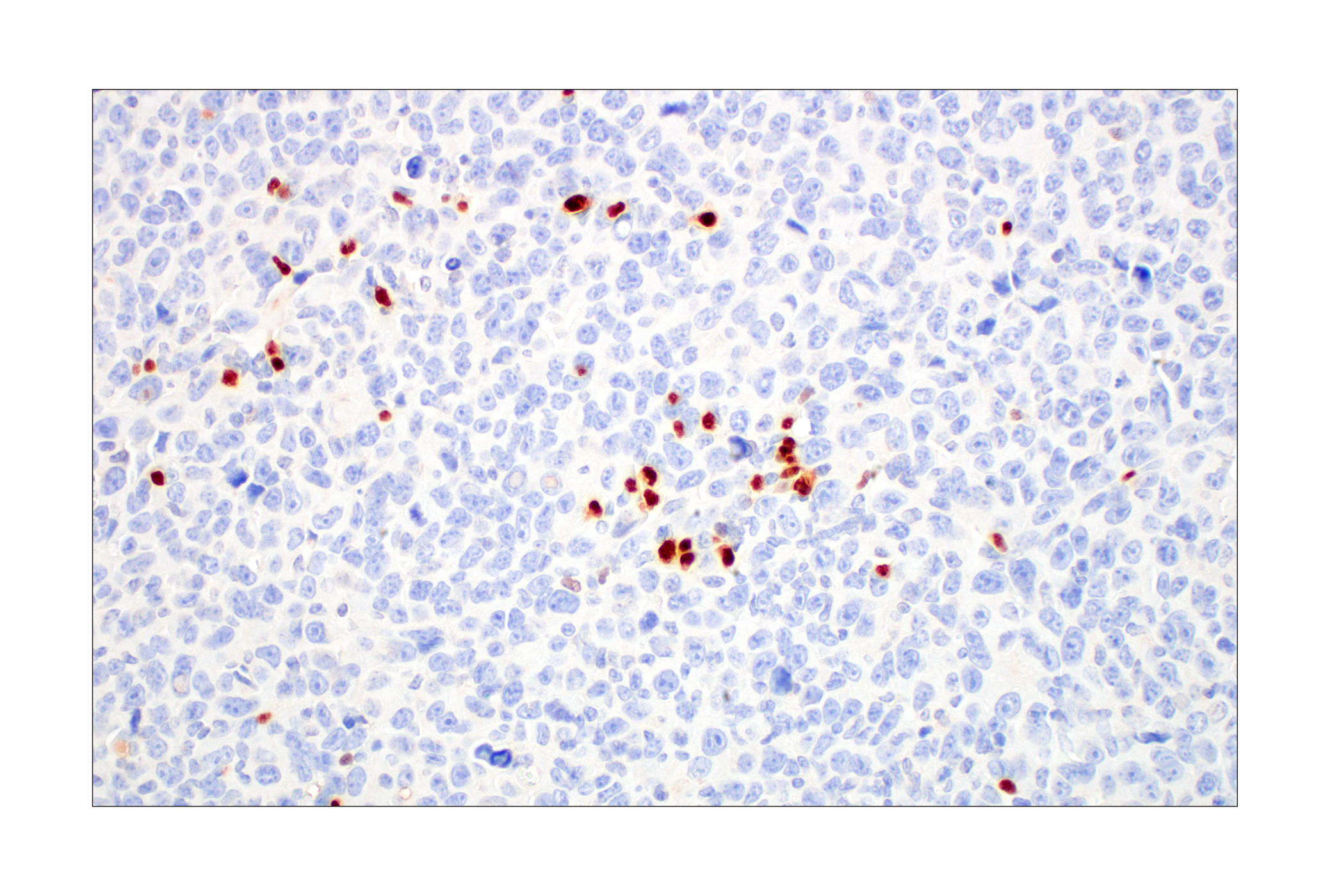 Immunohistochemistry Image 10: T-bet/TBX21 (E4I2K) Rabbit mAb (BSA and Azide Free)