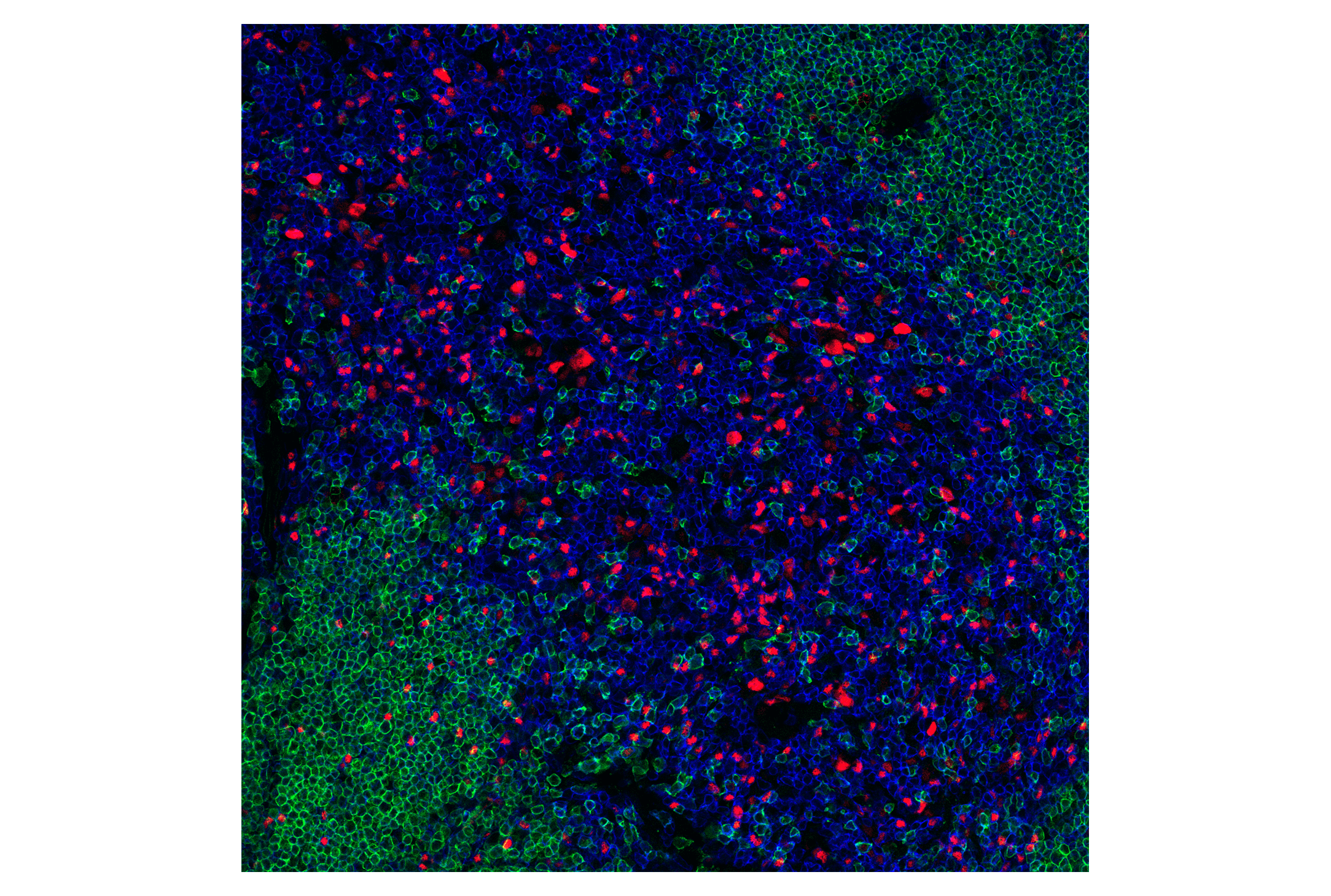 Immunofluorescence Image 1: T-bet/TBX21 (E4I2K) Rabbit mAb (BSA and Azide Free)