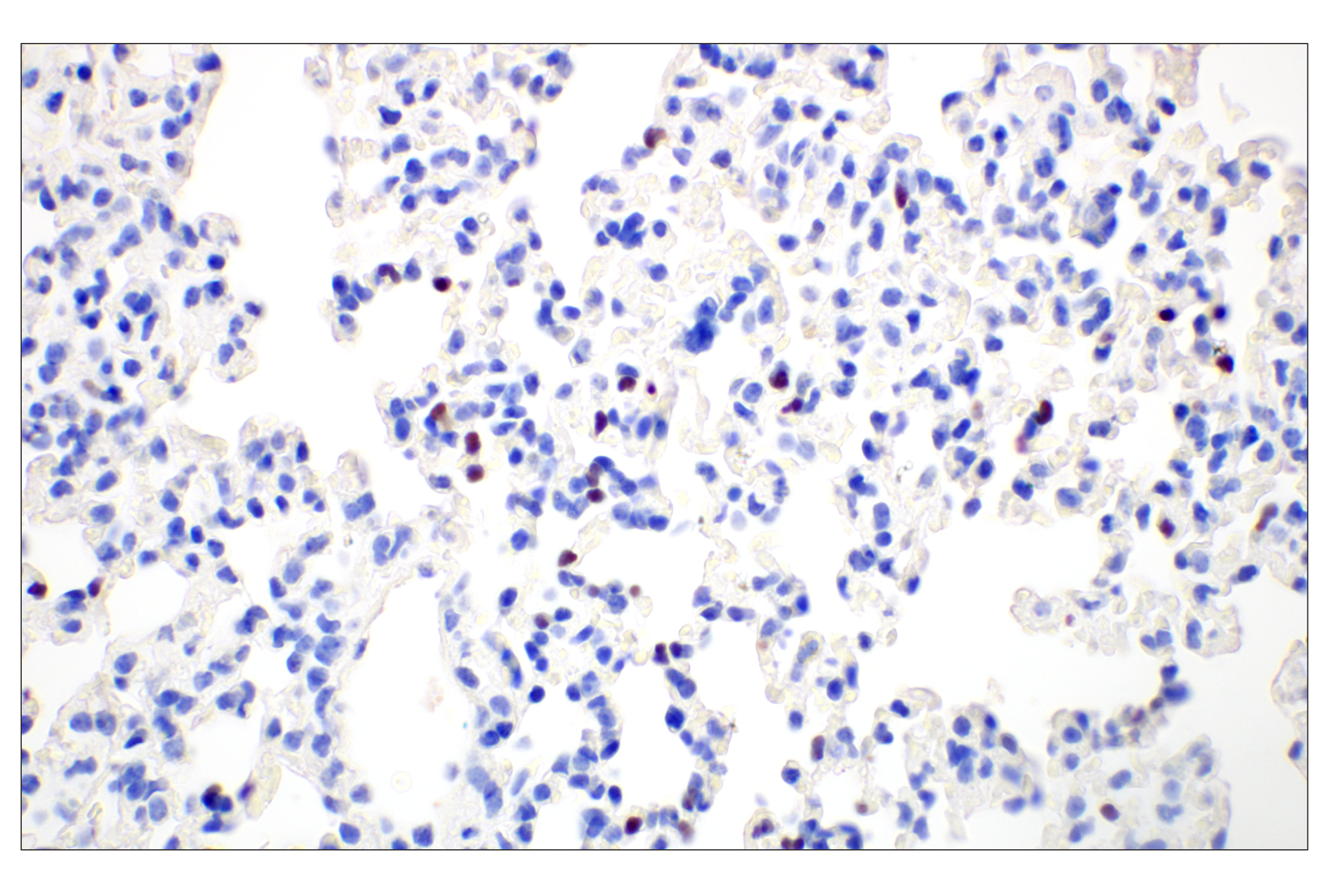 Immunohistochemistry Image 7: T-bet/TBX21 (E4I2K) Rabbit mAb (BSA and Azide Free)