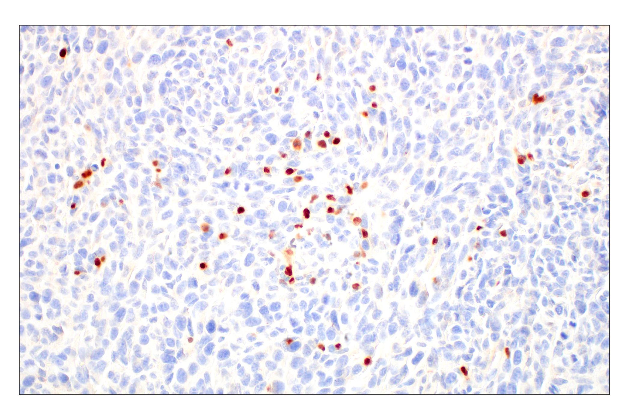 Immunohistochemistry Image 9: T-bet/TBX21 (E4I2K) Rabbit mAb (BSA and Azide Free)