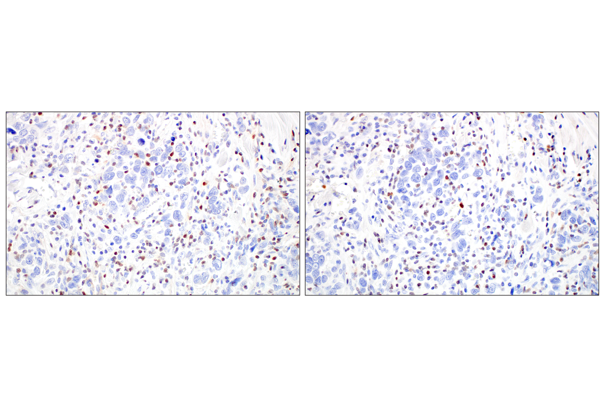Immunohistochemistry Image 11: T-bet/TBX21 (E4I2K) Rabbit mAb (BSA and Azide Free)