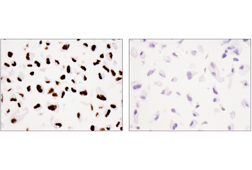 Immunohistochemistry Image 3: Tri-Methyl-Histone H3 (Lys36) (D5A7) XP® Rabbit mAb (BSA and Azide Free)