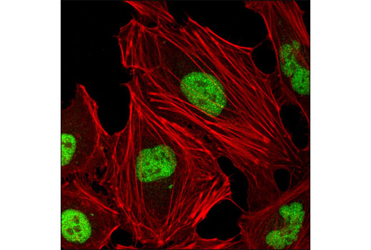 Immunofluorescence Image 1: JMJD1B (6A1-1F5) Mouse mAb