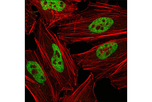 Immunofluorescence Image 1: hnRNP A1 (R196) Antibody