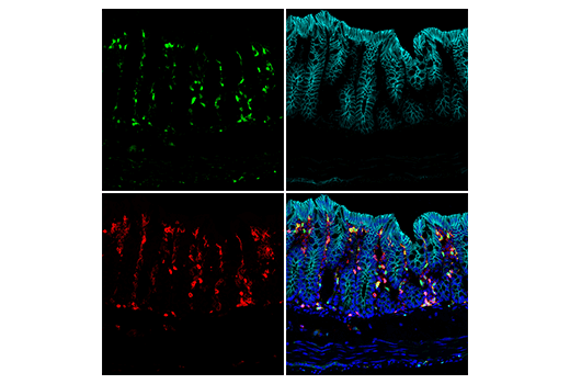 Immunofluorescence Image 1: TIPE2 (E5Q2S) Rabbit mAb