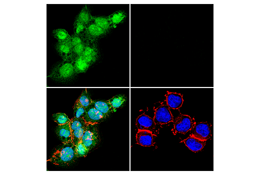 Immunofluorescence Image 6: TIPE2 (E5Q2S) Rabbit mAb