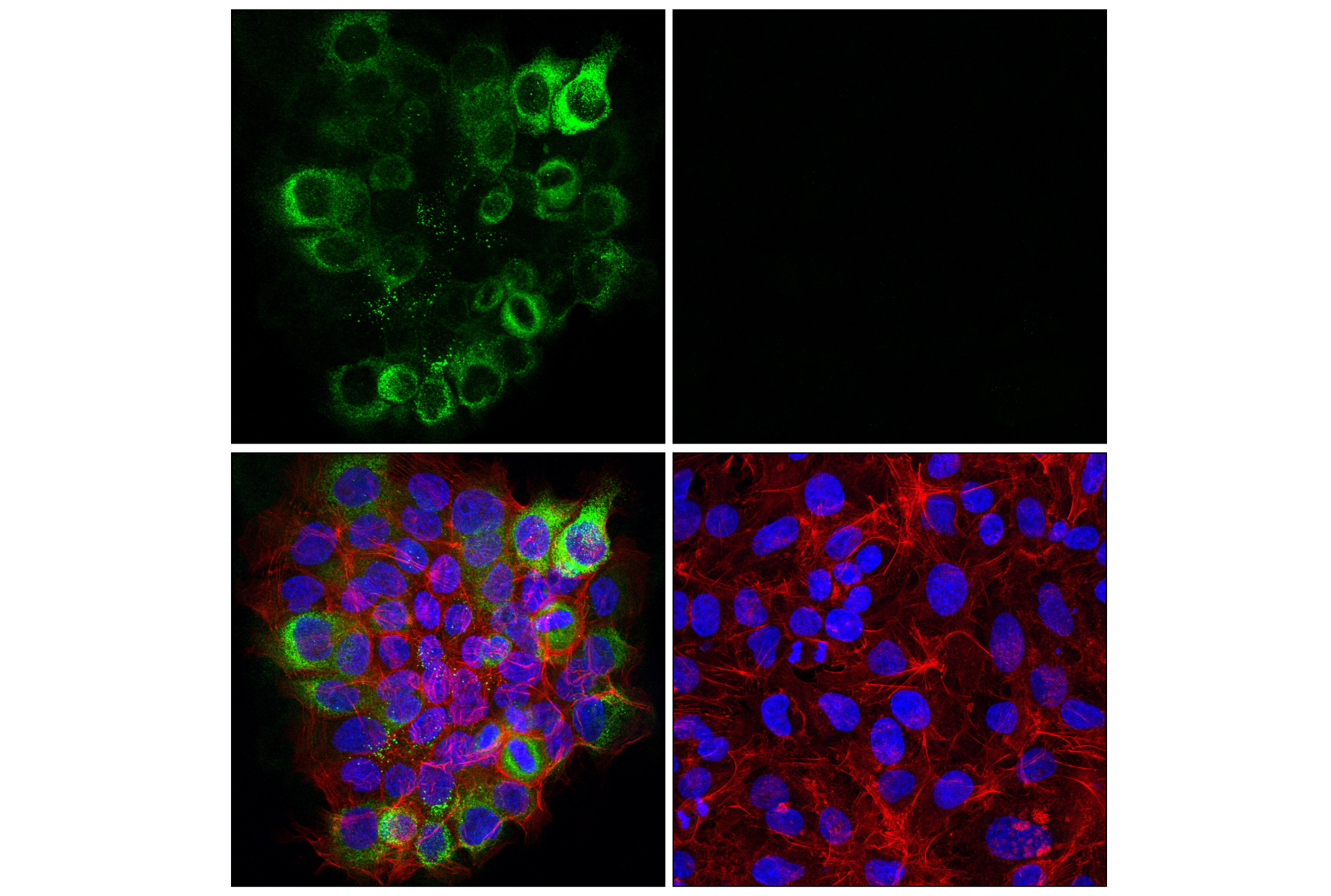 Immunofluorescence Image 1: LAMC2 (E9F7M) Rabbit mAb