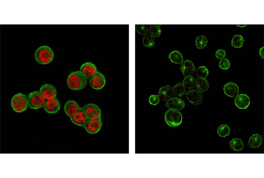 Immunofluorescence Image 1: p53 (7F5) Rabbit mAb (Alexa Fluor® 555 Conjugate)