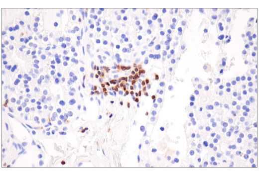 Immunohistochemistry Image 1: SLAMF6/CD352 (E3H1E) XP® Rabbit mAb (BSA and Azide Free)